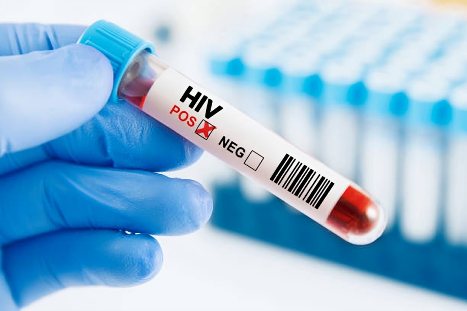 Global Mystery: Why Are 4,000 Young Women Infected With HIV Every Week?