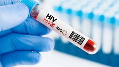 4,000 Young Women Infected With HIV Every Week