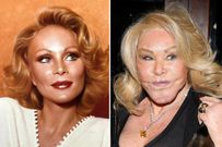 Jocelyn Wildenstein the “Catwoman” [Yahoo]
