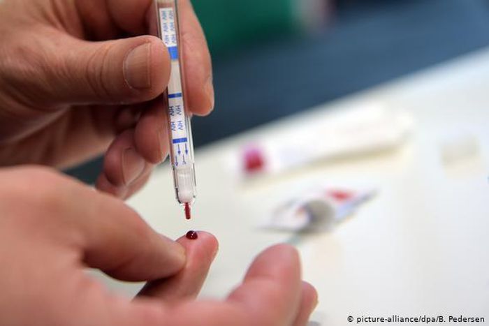 FG approves new test kit for HIV. [dw]