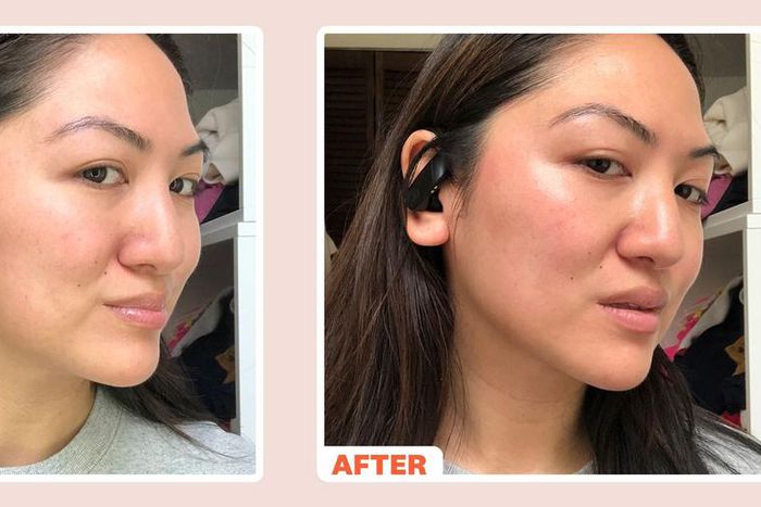 What Is a Microcurrent Facial?