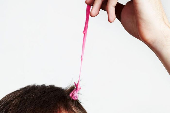 Watch Dr. Pimple Popper Pop a 'Bubble Gum' Cyst