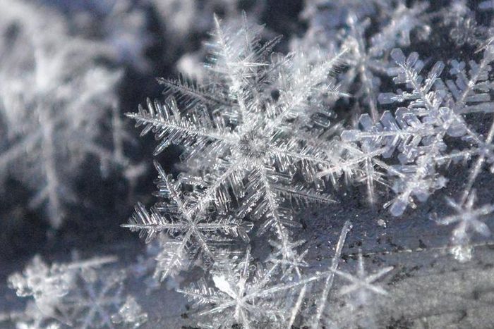 Watch Dr. P Extract A Snowflake Of A Pilar Cyst