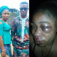 Man beats up wife, inserts hand in her genital to pull out 3-month-old pregnancy she refused to abort