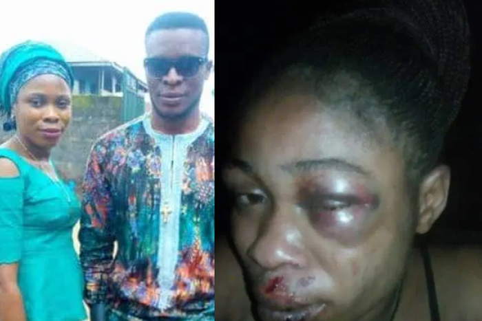 Man beats up wife, inserts hand in her genital to pull out 3-month-old pregnancy she refused to abort