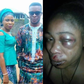 Man beats up wife, inserts hand in her genital to pull out 3-month-old pregnancy she refused to abort