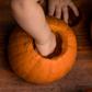 Watch Dr. P Pull Out A 'Pumpkin Guts' Lipoma