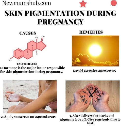 Skin hyperpigmentation in pregnancy: Causes, prevention, remedies