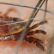The Right Way to Get Rid of Ticks