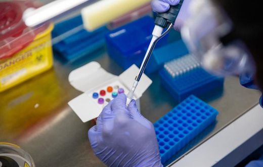 Coronavirus (COVID-19) test in a Nigerian lab [NCDC]