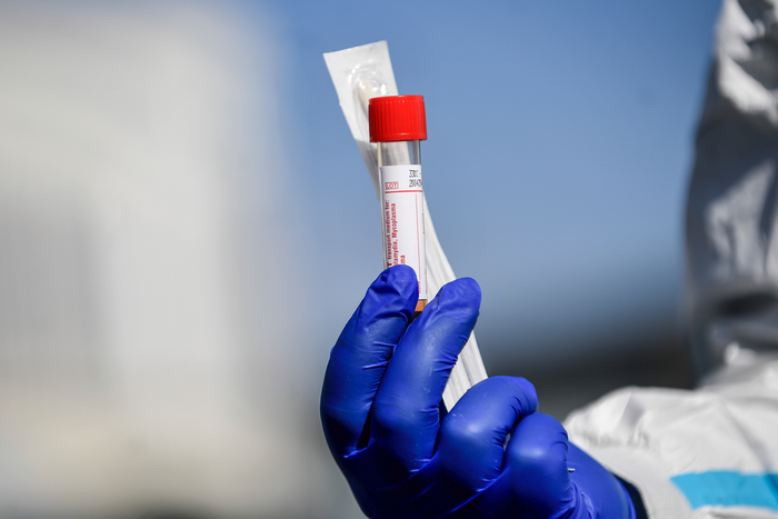 coronavirus test