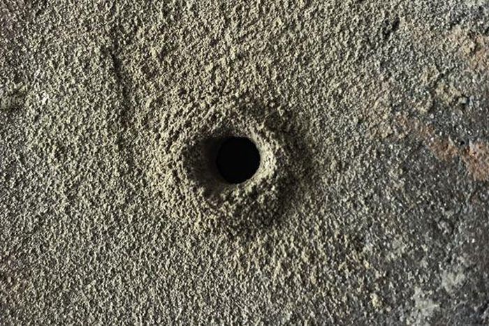 Dr. Pimple Popper Tweezes Out Huge Blackhead