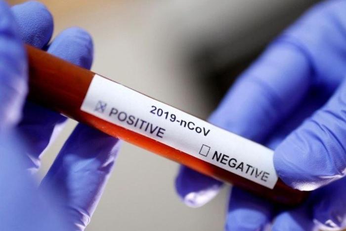 Laboratory technician holds up a Covid-19 positive sample in a vial (Reuters)