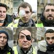 Scores of yellow vest protesters were maimed by rubber bullets or stun grenades, some losing an eye or a hand