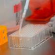 Mmore than 100 vaccine research projects are under way around the world, according to an analysis published Monday