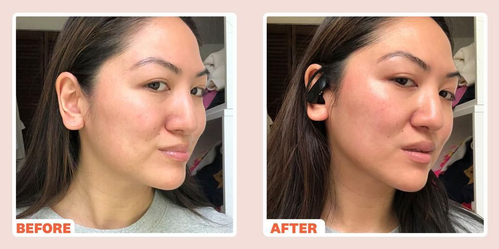 Notice the difference in my jawline!