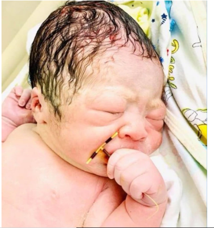 Baby comes out of mother’s womb holding failed family planning device firmly in his hand (photos)