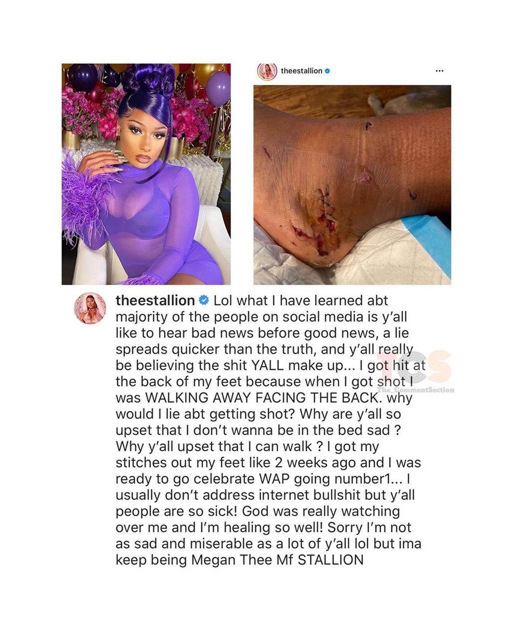 Reports indicates that the rapper was shot by Tory Lanez during an altercation back in July. [TheCommentSection]