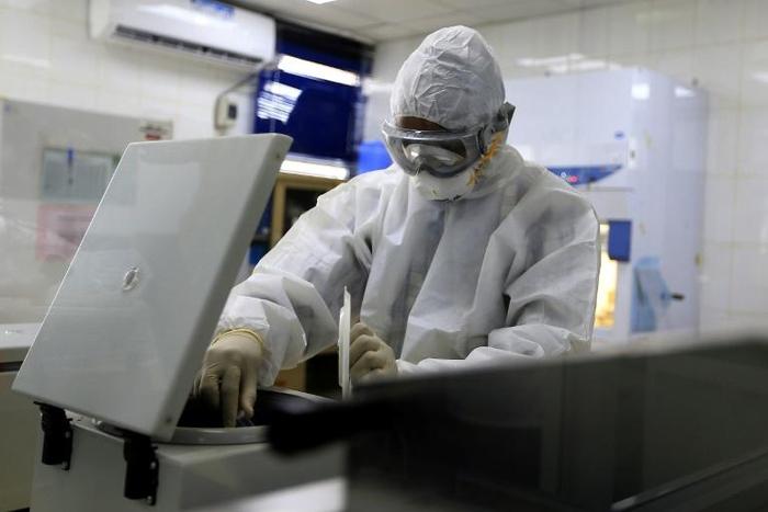 Aid workers warn that after years of war between the Saudi-backed government and pro-Iran rebels, Yemen's healthcare system lacks the capacity to deal with a major coronavirus outbreak