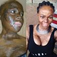 Woman recalls how she lost her daughter after lover set them ablaze