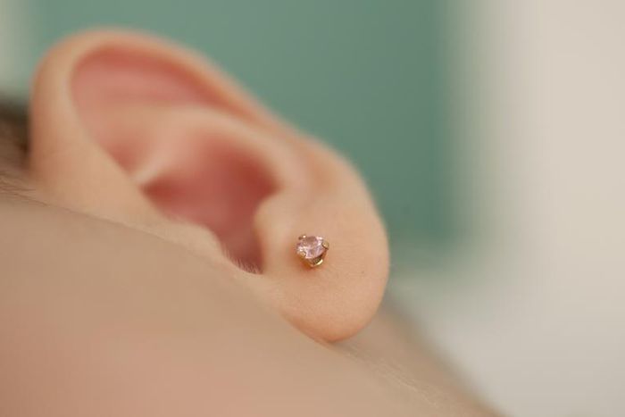 Dr. P Extracts A 'Little Ear Piercing' Blackhead