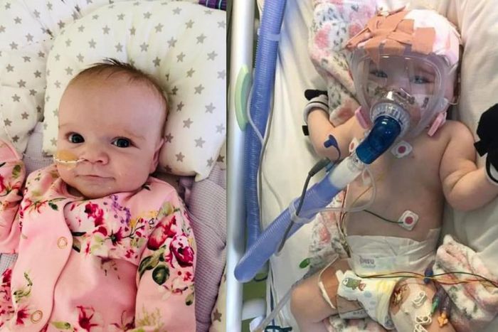 6-month-old baby survives open-heart surgery, gets infected with COVID-19 again; mom seeks prayers