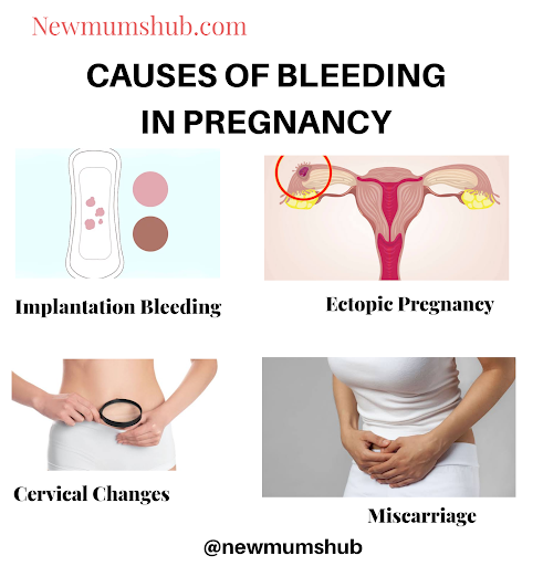 Bleeding in early pregnancy:  Common causes & symptoms