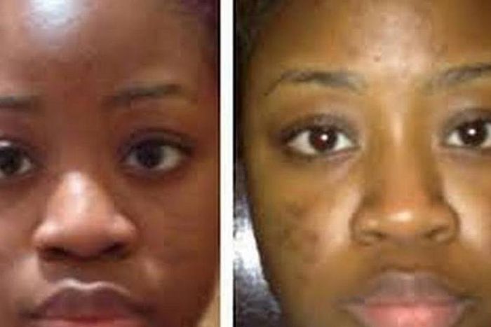 14 home remedies that cure pimples fast