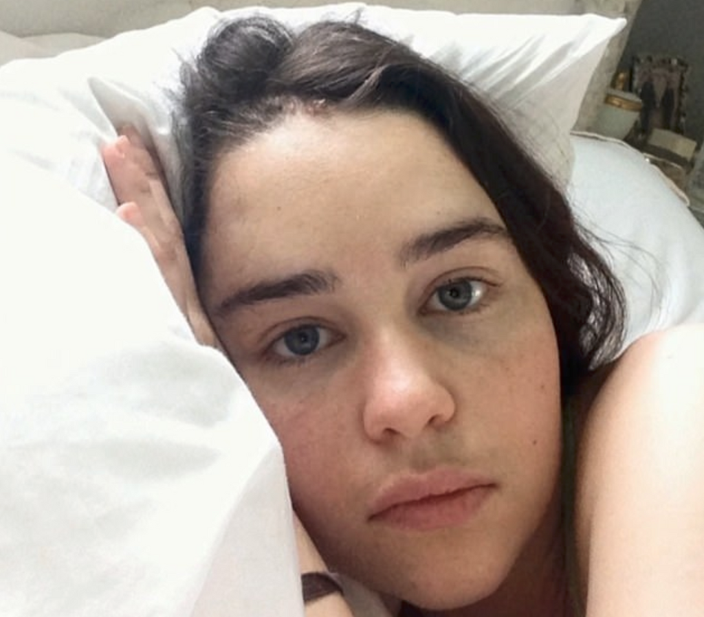 Emilia Clarke Shares New Pics After Brain Surgery