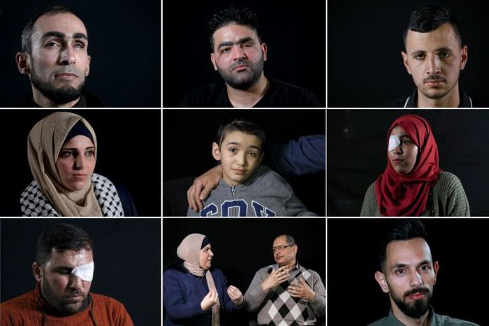 AFP met with Palestinians who lost an eye after being shot by the Israeli army, in Gaza, Jerusalem or the West Bank