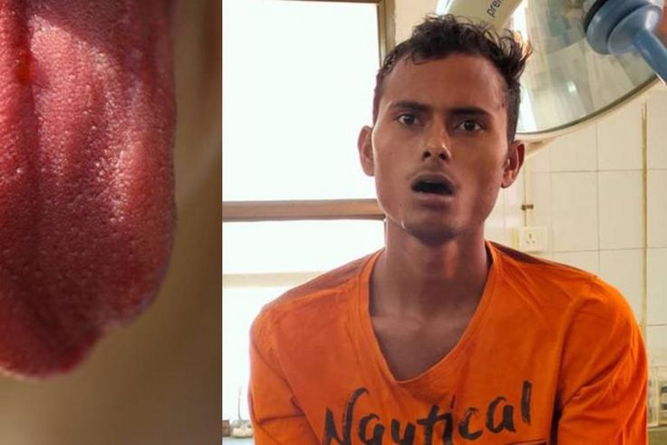 ‘Concerned’ man cuts off his tongue for sacrifice to stop the spread of COVID-19