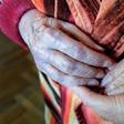 A controversial Hungarian government order forced hospitals to free up beds for potential COVID-19 patients