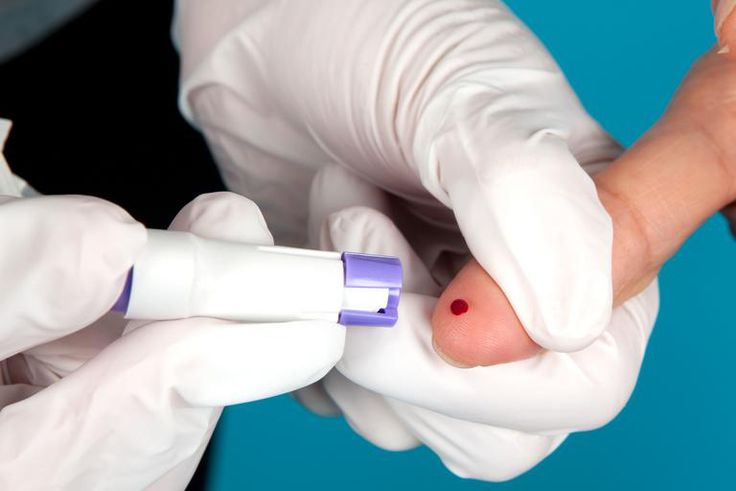 Should You Get a COVID-19 Antibody Test?