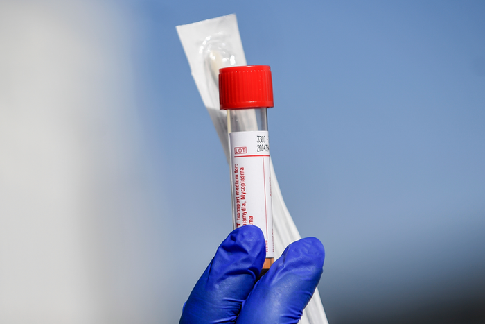 coronavirus test
