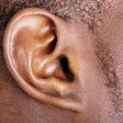 Expert says 8.5m Nigerians suffering from hearing impairment. (wisegeek)