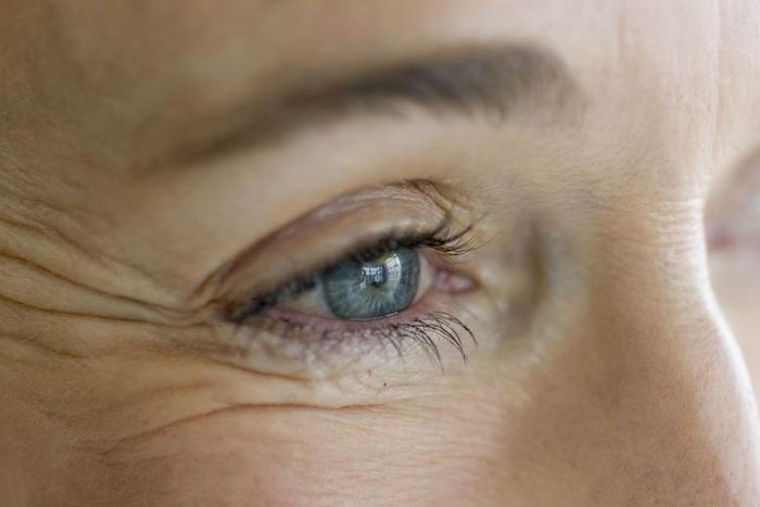 Dr. Pimple Popper Squeezes DPOW On Woman's Eye