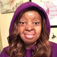 Kechi Okwuchi: "If you’re not dead, God’s not done" - Plane crash survivor recounts her ordeal