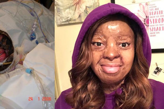 Kechi Okwuchi: "If you’re not dead, God’s not done" - Plane crash survivor recounts her ordeal