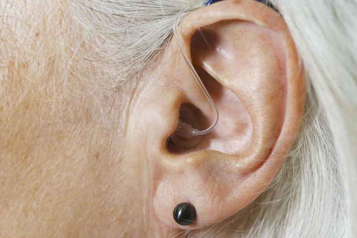 Watch Dr. P Extract An 'Earring' Blackhead