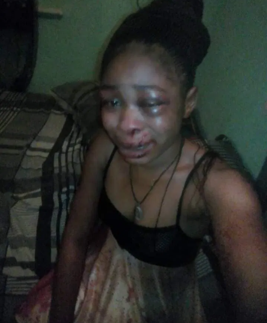 Man beats up wife, inserts hand in her genital to pull out 3-month-old pregnancy she refused to abort