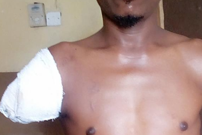 Man loses arm while serving Court summons to defendant's family. (Photo used for the purpose of illustration) [thenigerianvoice]