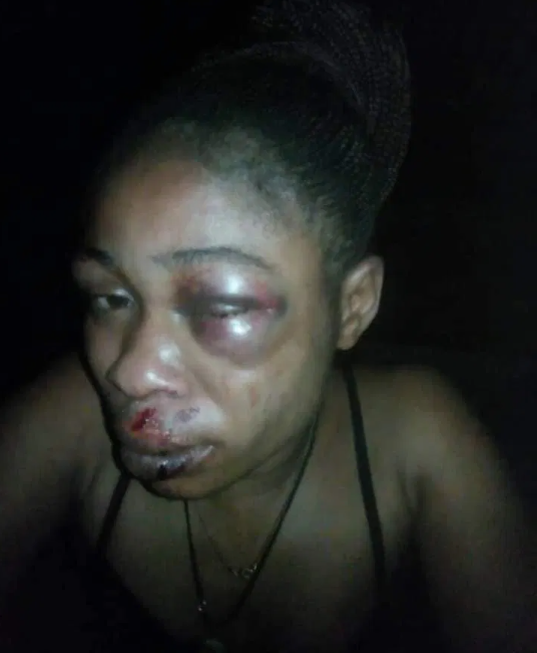 Man beats up wife, inserts hand in her genital to pull out 3-month-old pregnancy she refused to abort