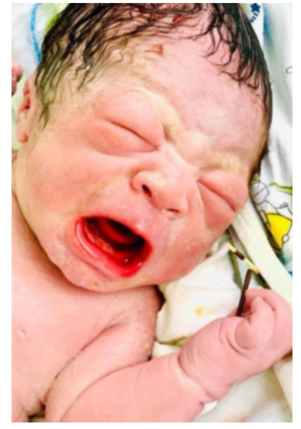 Baby comes out of mother’s womb holding failed family planning device firmly in his hand (photos)