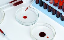 8 important medical tests every couple MUST take before marriage