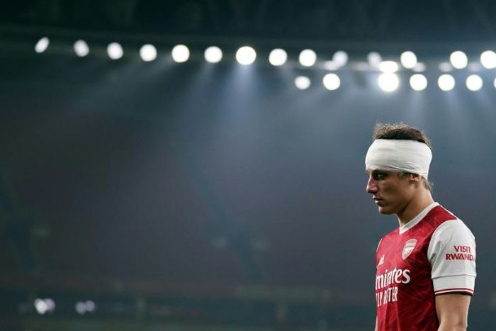 Arsenal defender David Luiz played on for 40 minutes after suffering a head knock in a clash that left Raul Jimenez with a fractured skull