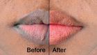 Lips: Here are 5 naturally ways to make them soft and pink [Medium]
