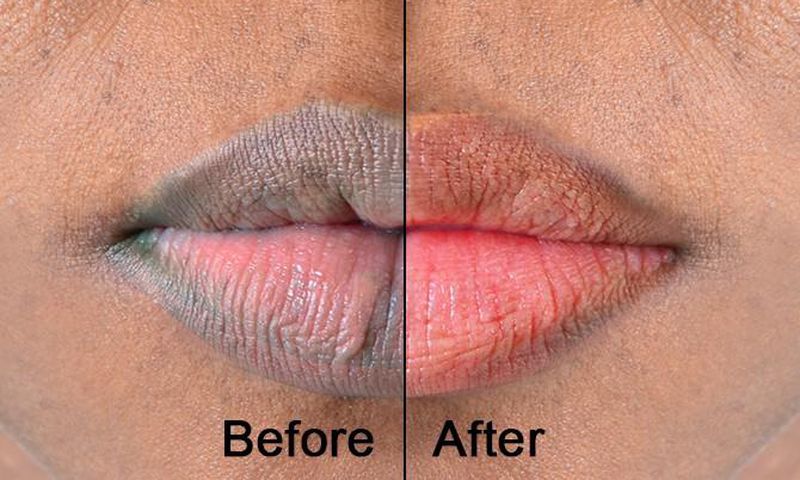 Lips: Here are 5 naturally ways to make them soft and pink [Medium]