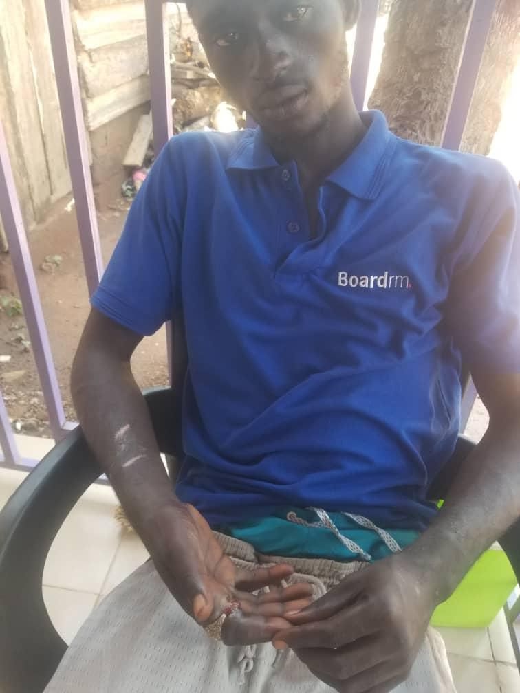 Pantang teenager's index finger rots away after wearing stolen ‘spiritual’ ring