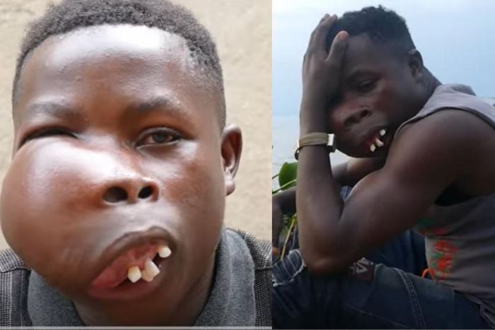 “I feel jealous when I see people’s faces” – Noah, 19-year-old orphan