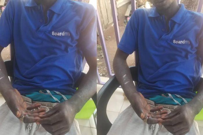Pantang teenager's index finger rots away after wearing stolen ‘spiritual’ ring